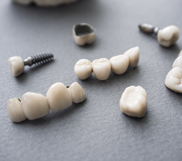 Chester The Difference Between Dental Implants and Mini Dental Implants